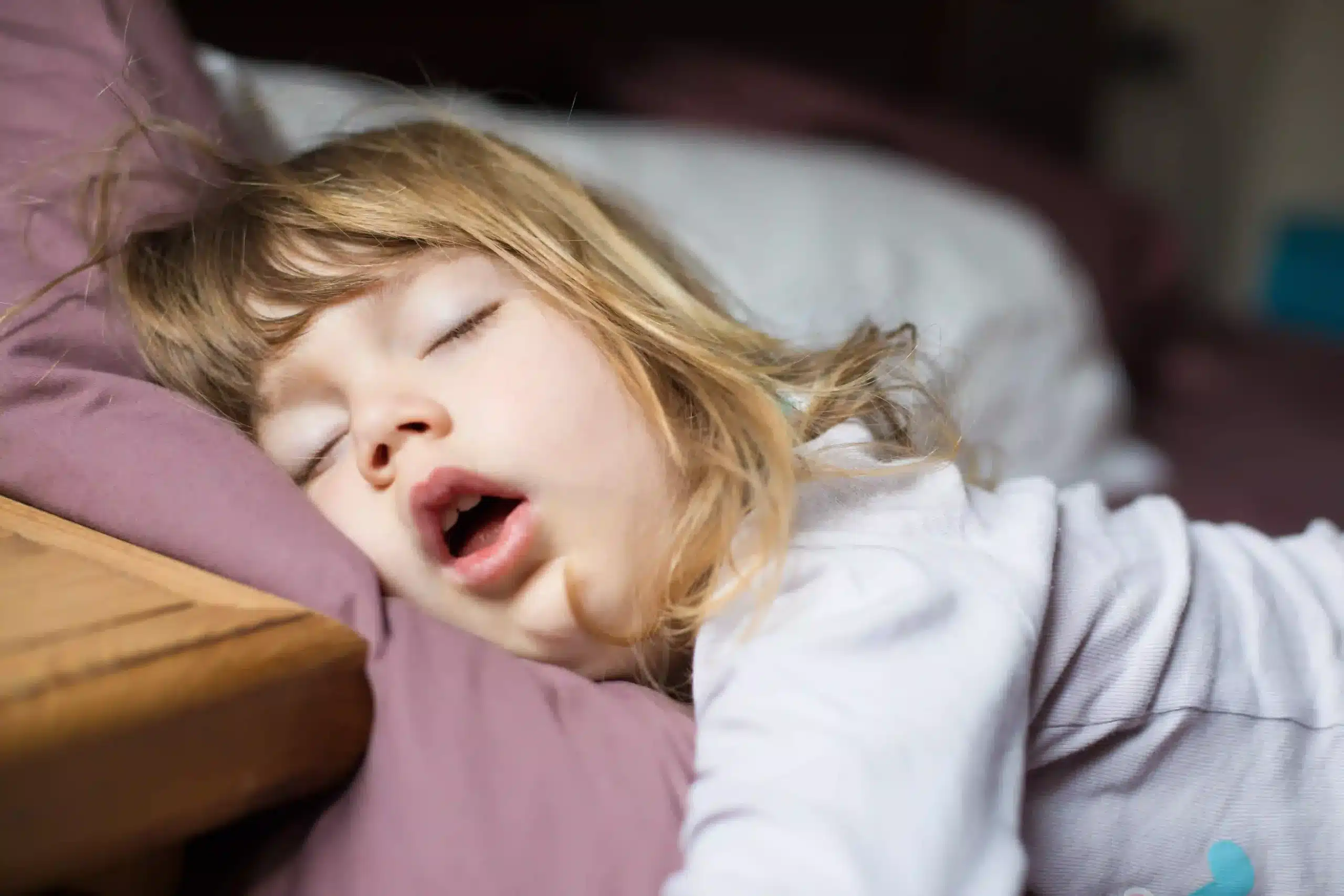 Mouth Breathing in Children