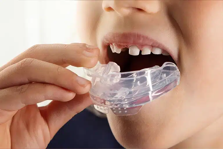 Myobrace