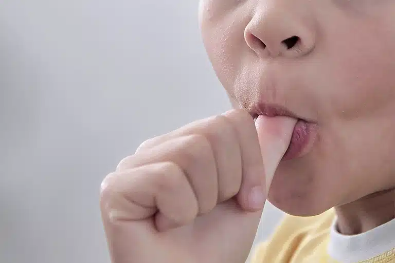 Thumb Sucking Elimination