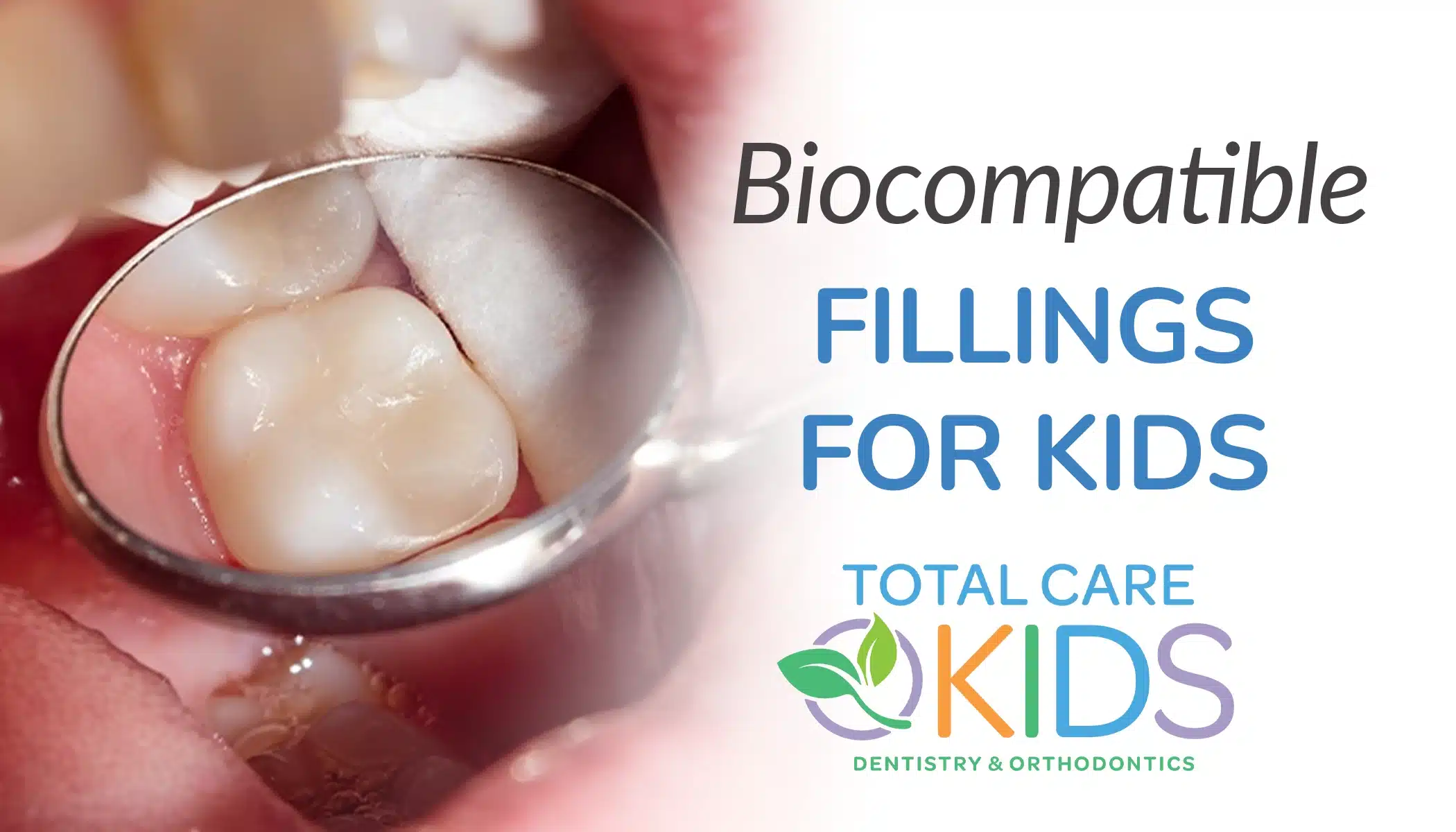 biocompatible fillings for kids