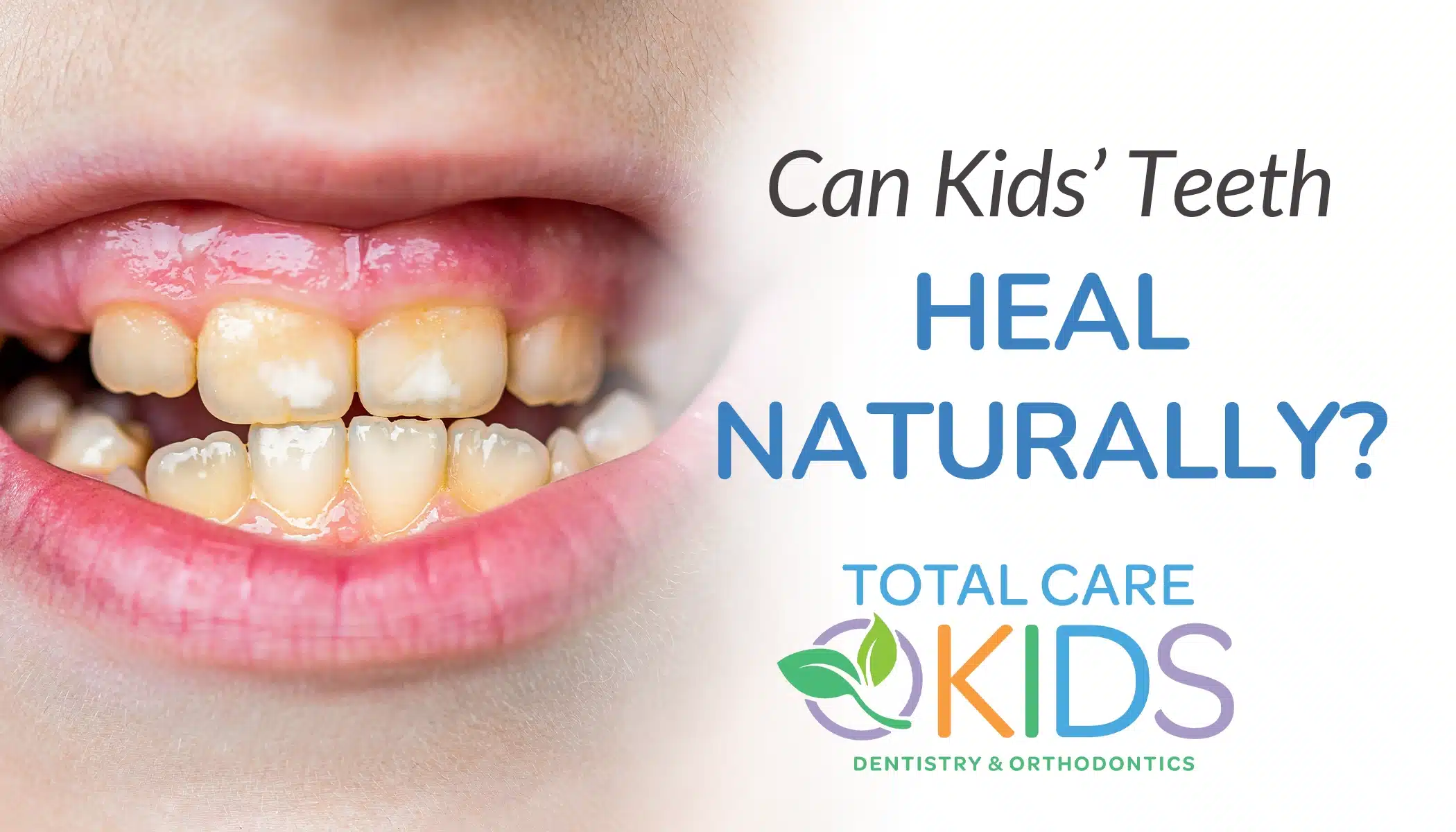 can kids teeth heal naturally