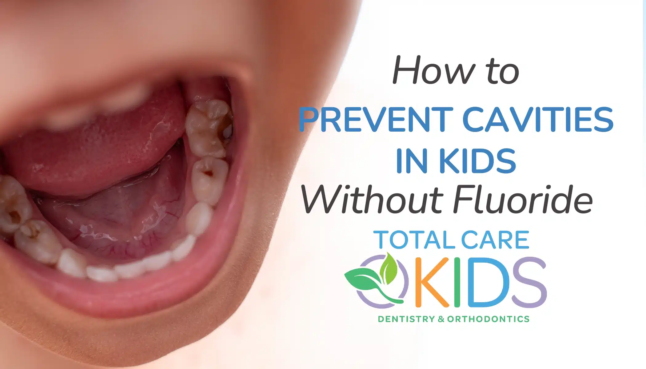 how to prevent cavities in kids banner