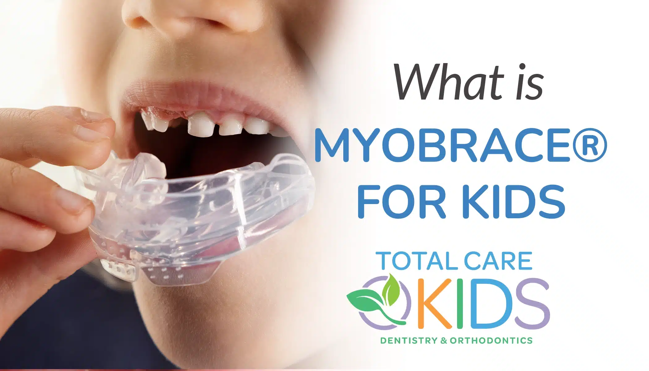 what is myobrace for kids